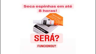 TESTEI O GEL SECATIVO PARA ESPINHAS RAPID CLEAR NEUTROGENA [upl. by Irakab]