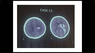 RADIOLOGY EXAM CASES [upl. by Onnem483]