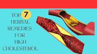 TOP 7 HERBAL REMEDIES FOR HIGH CHOLESTEROL [upl. by Colly]