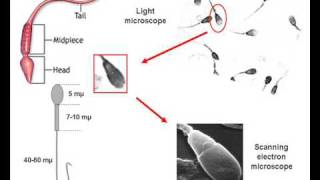 SWIMMING SPERMATOZOA IN SEMEN [upl. by Lotsirk]