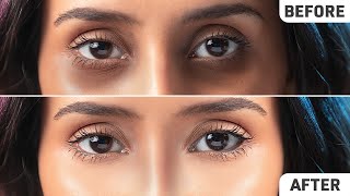 Remove Dark Circles Permanently FAST  Natural Home Remedies [upl. by Nonnad]