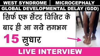 West Syndrome Recovery  Microcephaly Baby Treatment  Global Developmental Delay Case Presentation [upl. by Devlen]