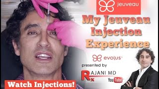 My Jeuveau Experience and Injections Dr Rajani [upl. by Enelrad]