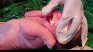 New born baby looking so beautifull delivred by nvd baby came with thick vernix cleaning done 💞❣️ [upl. by Lahcar77]