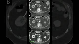 Whats the diagnosis⚕Readthedescription pathology medicine diagnosis [upl. by Scott]