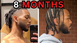 How To Grow Out Your Sides 8 Month Undercut Journey [upl. by Nidraj]