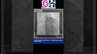 Coronary Angiography CAG Procedure  Deepak Heart institute [upl. by Anitra]