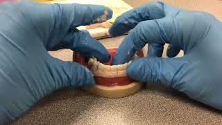 Periodontal Dressing [upl. by Mairem]