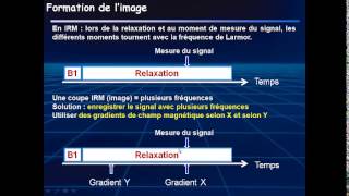 IRM PCEM2 [upl. by Carie283]