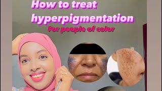 SIDEED ISKAGA DAWAYN LAHAYD HAARAHA MAQAARKA KU DHAGA  HOW TO TREAT HYPERPIGMENTATION  DRasmaidi [upl. by Aneeuqal]