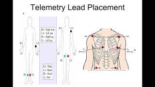 Basic ECGs For Nursing and Paramedic Students [upl. by Yentnuoc]