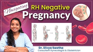 Navigating RH Negative Pregnancy  DrDivya Swetha  Ankura Hospital Madeenaguda [upl. by Eimerej]