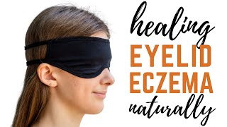 Healing Eyelid Eczema Naturally  Eyelid Atopic Dermatitis Triggers [upl. by Radley390]