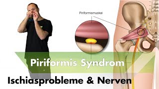 Ischialgie amp Piriformissysndrom  Nervensystem  Das solltest du über Schmerzen wissen [upl. by Brandenburg]