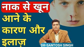 Naak Se Khoon Aane Ke Upay  Nose Bleeding EPISTAXIS Causes amp Treatment Explained [upl. by Baskett999]