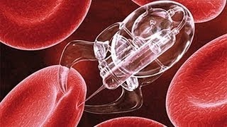 Nanotechnologie Dokumentarfilm Revolutioniert die Medizin und die Gesundheitspflege [upl. by Alford]