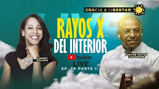 Rayos X del INTERIOR parte2 🩻  772024 rayosx interior programacristiano [upl. by Quintin883]