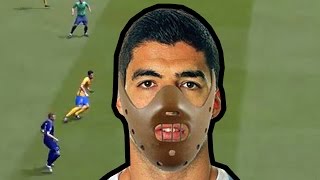 FIFA 16 FUTEBOL ARTE  Suarez e Sua Contusão Suspeita [upl. by Aiepoissac]