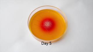 DTM Fungal Culture Growth of Ringworm [upl. by Aileve]