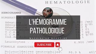 Interprétation dun hémogramme pathologique  exemples [upl. by Debera146]