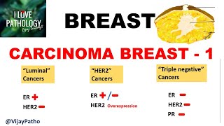 Diseases of Breast Part 4 Breast carcinoma risk factors pathogenesis amp classification [upl. by Esorlatsyrc]