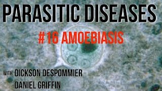 Parasitic Diseases Lectures 16 Amoebiasis [upl. by Dloreg22]