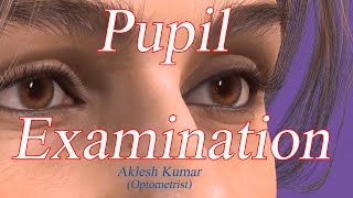 Pupil Examination  RAPD  Pupillary Light Reflex  Marcus Gunn Pupil  Swinging flashlight Test [upl. by Flower10]