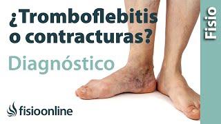 Cómo diferenciar una tromboflebitis de un dolor muscular de la pantorrilla o contractura muscular [upl. by Htide639]