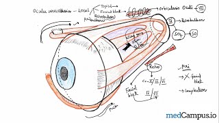 Peribulbar block vs retrobulbar block  Ocular anesthesia  Ophthalmology medcampus [upl. by Lahcear848]