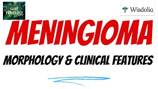 MENINGIOMA  Part 2  Histopathology  Clinical features Treatmentamp prognosis [upl. by Naugan]