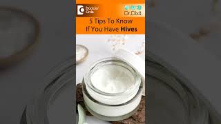 URTICARIA  HIVES  5 IMPORTANT Tips to Know  Skin Allergy DrRasya Dixit Doctors Circle shorts [upl. by Lerrad]