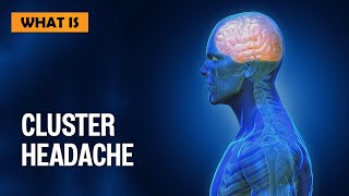 What is Cluster Headache [upl. by Aisya679]