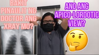 XRAY VLOG7 OK LANG BA NA ULITIN ANG XRAY KAHIT KAKA X RAYED PA LANG [upl. by Palua]