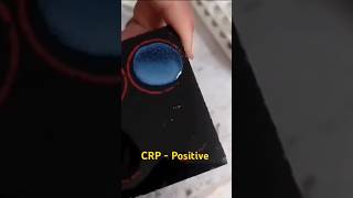 CRP test procedure  CRP blood test  medicalstudent youtube shorts [upl. by Goulden]