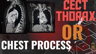 🫁 HOW TO DO CECT THORAXCHEST CONTRAST CT THORAX AXIAL SAGITTAL AND CORONAL📈 [upl. by Nohsauq88]