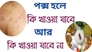 পক্স হলে কি খাওয়া যাবে  pox hole ki khabo [upl. by Annahael]