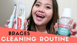 BRACES CLEANING ROUTINE  Best Products To Keep Teeth White Hygiene [upl. by Inavoig593]