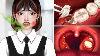 ASMR Dental Cleaning Procedures  Tonsil Stones Removal [upl. by Ahcas]