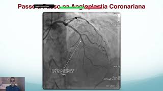 CARDIOLOGIA INTERVENCIONISTA 2024  PASSO A PASSO DA ANGIOPLASTIA CORONARIANA [upl. by Moriyama]