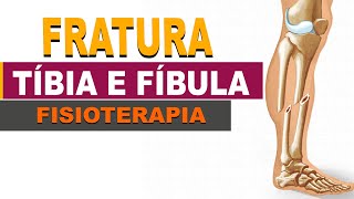 Fratura de Tíbia e Fíbula da Anatomia a Recuperação total  Parte 1 [upl. by Ariaek]