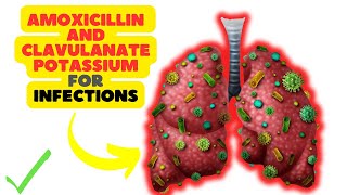 Amoxicillin and Clavulanate Potassium A DualAction Antibiotic for Bacterial Infections [upl. by Drandell]