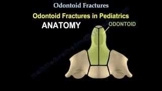 Odontoid Fractures  Everything You Need To Know  Dr Nabil Ebraheim [upl. by Nahraf]