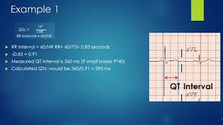 How to properly calculate a Qtc [upl. by Dnar997]