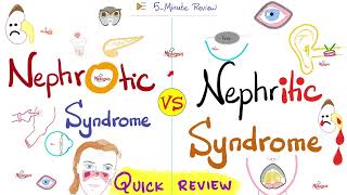 Nephrotic AND Nephritic Syndrome  Quick Review  Nephrology amp Pathology [upl. by Ailadgim]