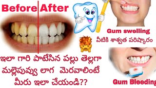 The Ultimate Guide to Neem for Oral Health Tooth Problems Solved 🤯teethwhitening [upl. by Elesig917]