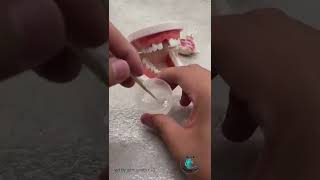 Polymer Beads Temporary Teeth DIY [upl. by Kerwon134]