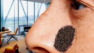 What happened to the infected nose animation Treating the nose using ASMR removing the larvae [upl. by Gib]