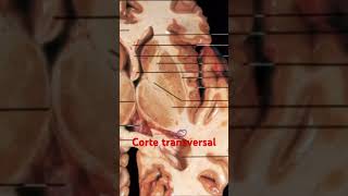 🧠¡Núcleos basales en cerebro real Video completo ⬆️⬆️ anatomia anatomiafacil anatomiapratica [upl. by Dagmar]