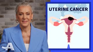 Early Signs of Uterine Cancer [upl. by Olmsted670]