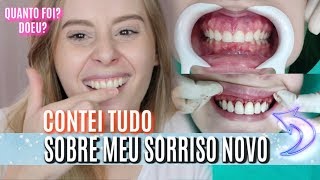 AUMENTEI MEUS DENTES doeu qual valor E MUITO MAIS [upl. by Parnell]